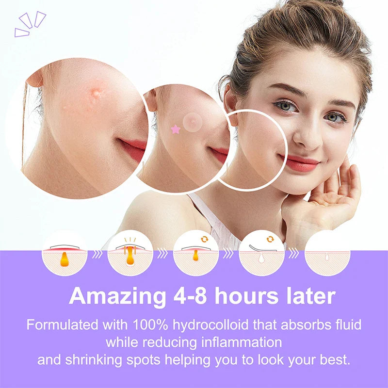 Colorful Acne Pimple Patches