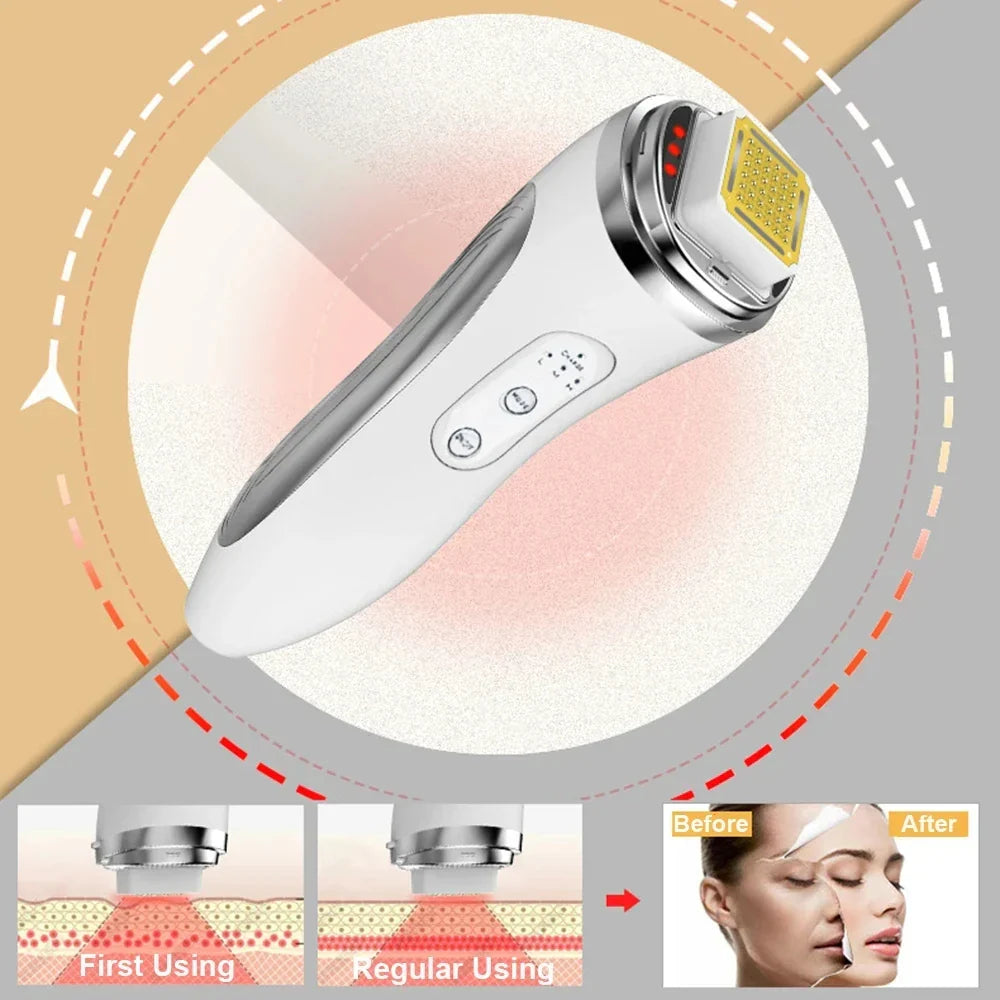 Electric Facial Lifting Machine