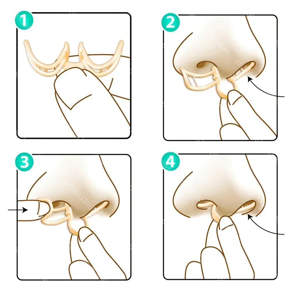 Snore Stopper Nasal Dilator