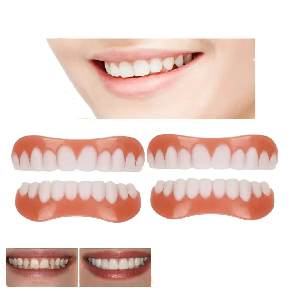 Perfect Smile Veneers Kit