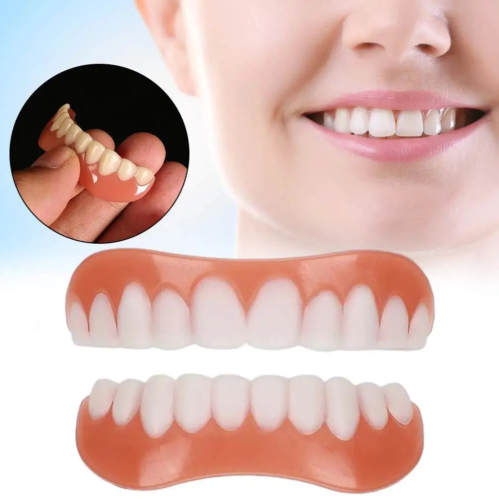 Perfect Smile Veneers Kit