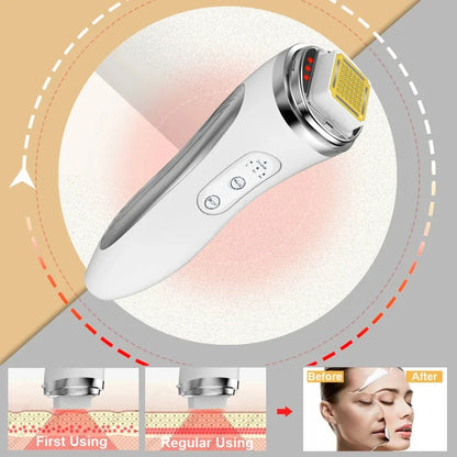 Electric Facial Lifting Machine