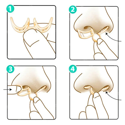 Snore Stopper Nasal Dilator