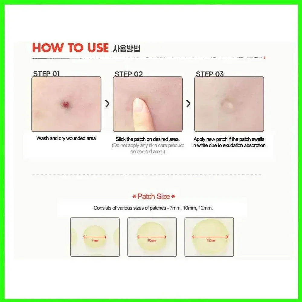 Acne Spot Treatment Patches