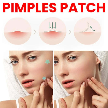 Star Pimple Patch Stickers