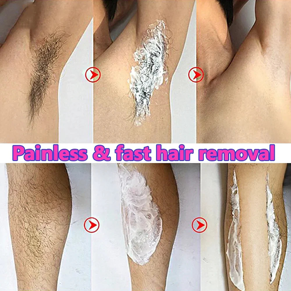 Fast Hair Removal Cream