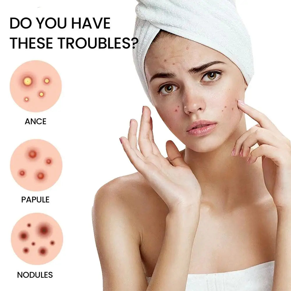 Star Pimple Patch Stickers
